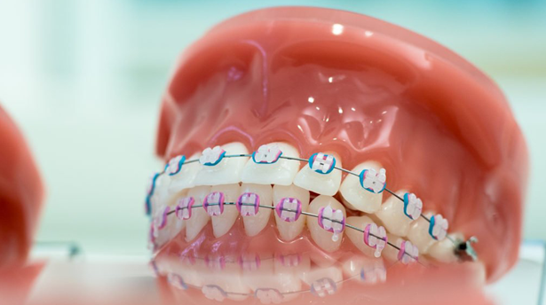 Disfunções da  atm